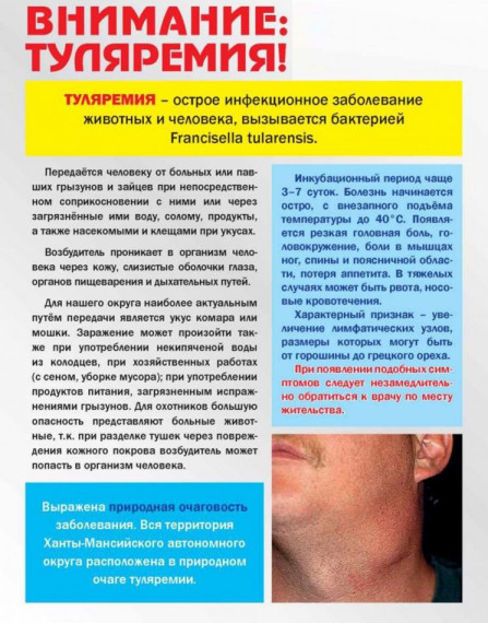 Памятка для населения. Профилактика туляремии. Памятка для населения. Профилактика туляремии.
